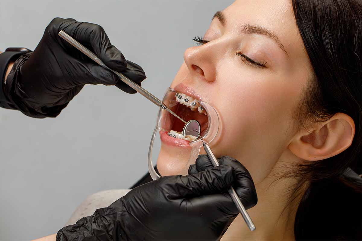 Kadıköy Ortodonti Tedavisi - Kemik Dental