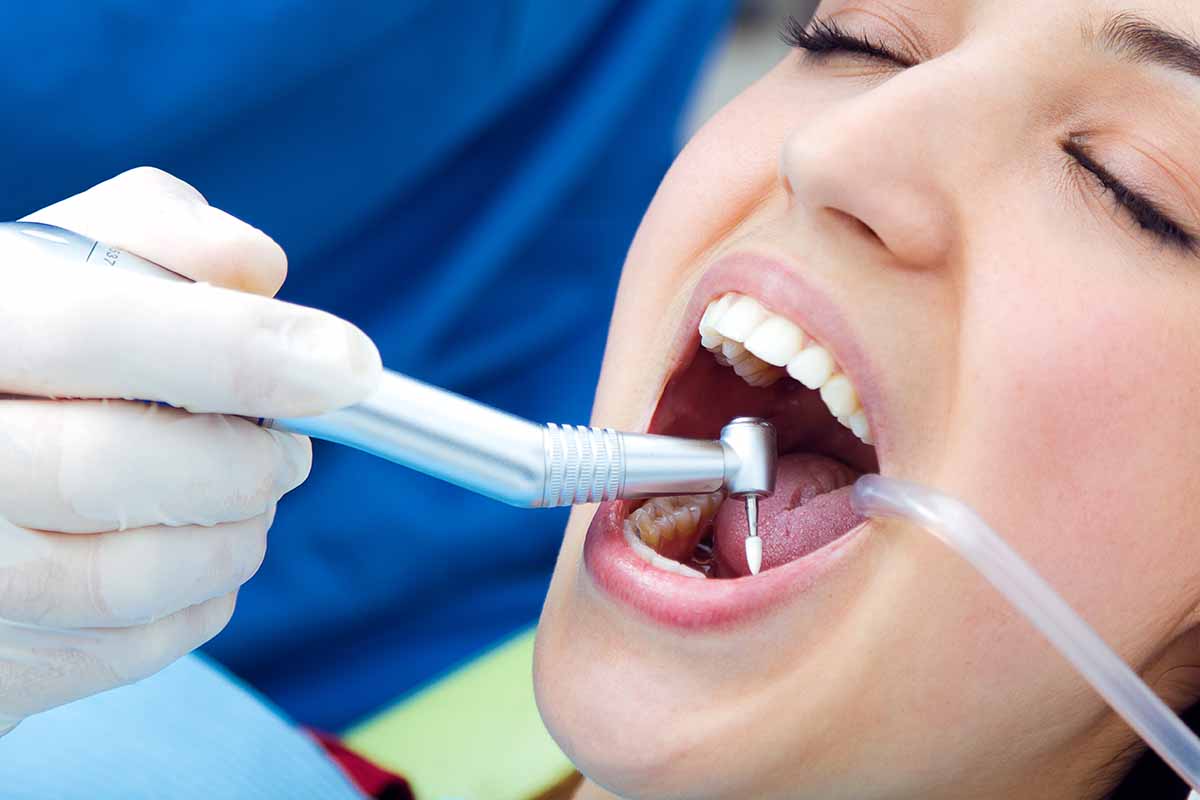 Kadıköy Diş Taşı Temizliği - Kemik Dental Clinic